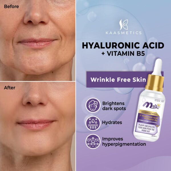 ANTI WRINKLE SERUM